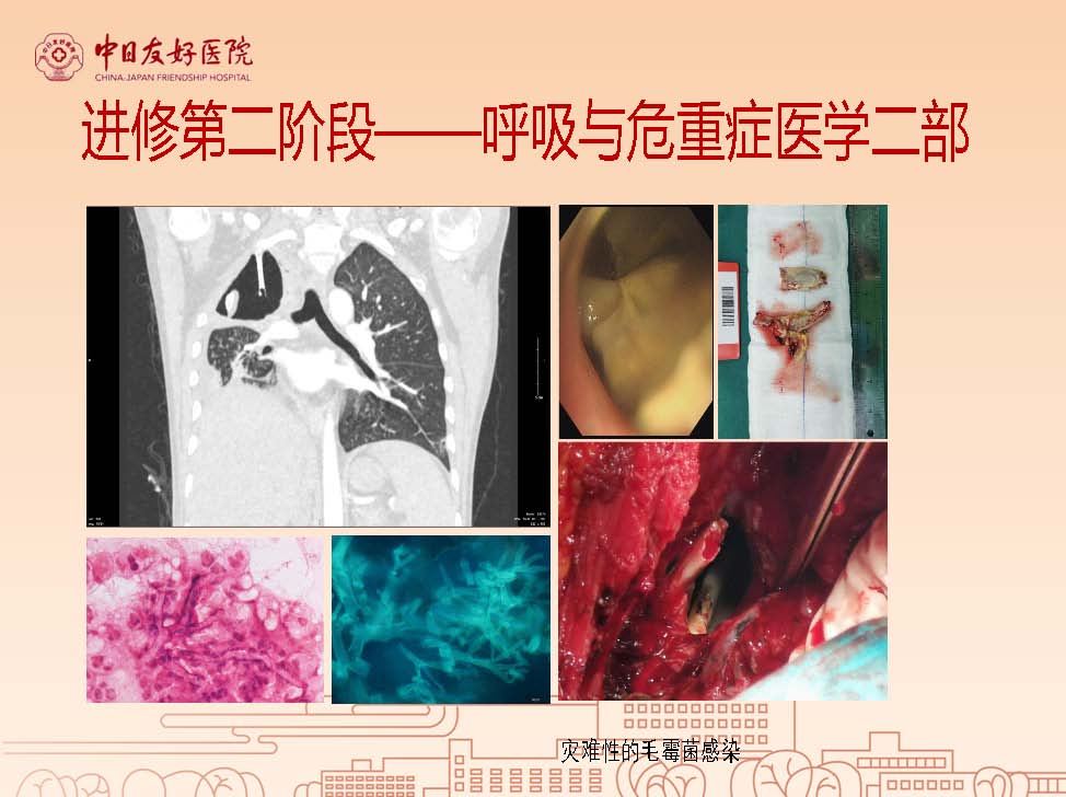 603289575ed04abcf97143541219c28b_81cac233bc8d573c7194a38325d366b5_8_页面_13.jpg